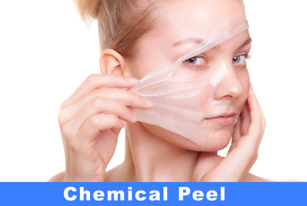 Chemical Peels